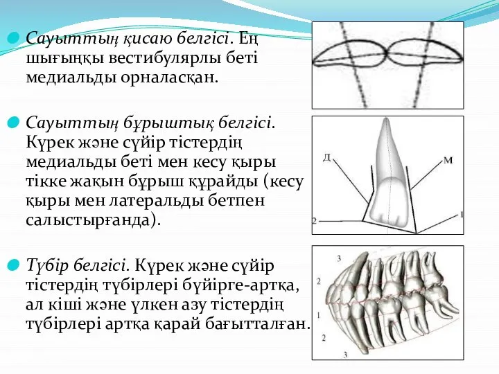 Сауыттың қисаю белгісі. Ең шығыңқы вестибулярлы беті медиальды орналасқан. Сауыттың бұрыштық белгісі.