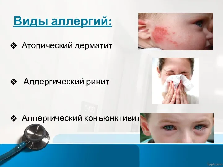 Виды аллергий: Атопический дерматит Аллергический ринит Аллергический конъюнктивит