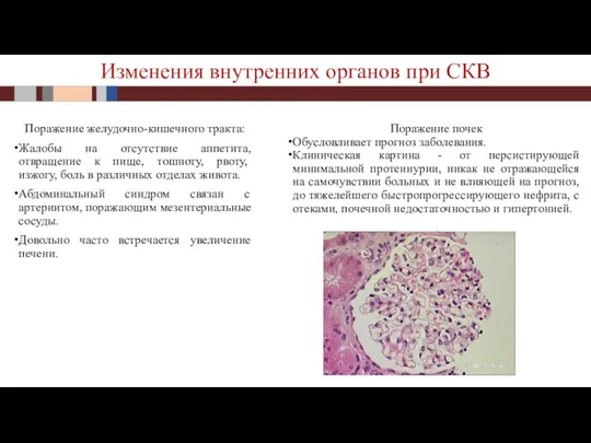 Поражение желудочно-кишечного тракта: Жалобы на отсутствие аппетита, отвращение к пище, тошноту, рвоту,