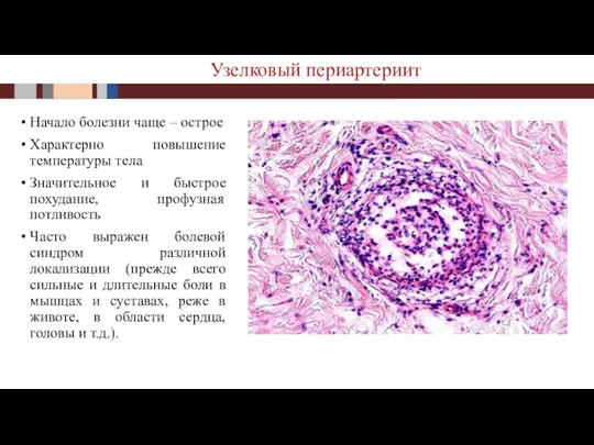 Начало болезни чаще – острое Характерно повышение температуры тела Значительное и быстрое