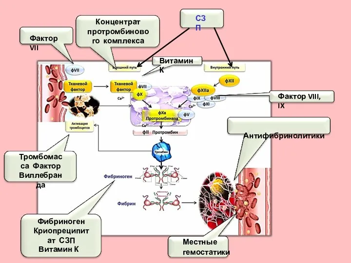 Фактор VII Концентрат протромбинового комплекса Тромбомасса Фактор Виллебранда СЗП Фактор VIII, IX