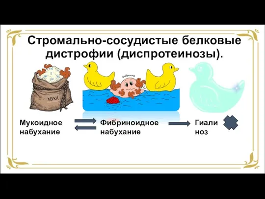 Стромально-сосудистые белковые дистрофии (диспротеинозы). Мукоидное набухание Фибриноидное набухание Гиалиноз