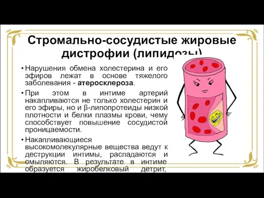 Стромально-сосудистые жировые дистрофии (липидозы) Нарушения обмена холестерина и его эфиров лежат в