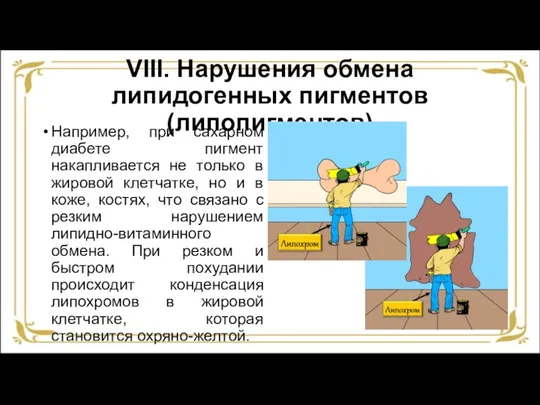 VIII. Нарушения обмена липидогенных пигментов (липопигментов) Например, при сахарном диабете пигмент накапливается