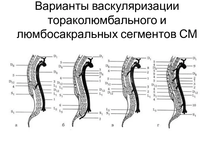 Варианты васкуляризации тораколюмбального и люмбосакральных сегментов СМ