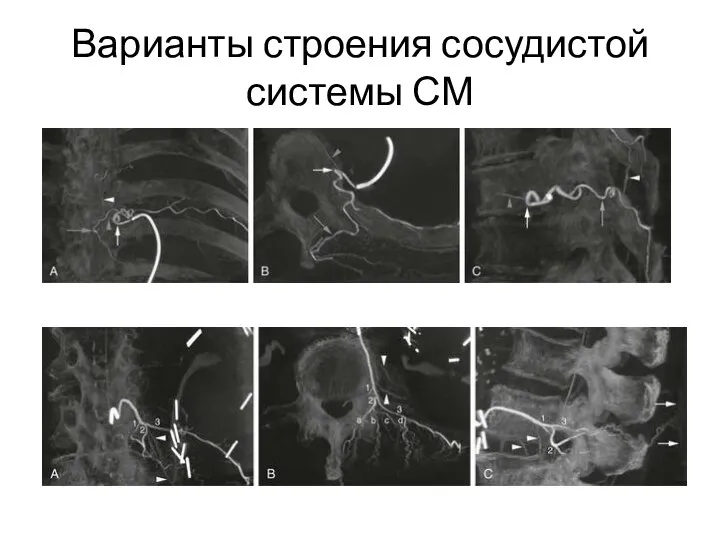 Варианты строения сосудистой системы СМ