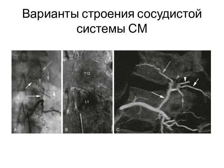 Варианты строения сосудистой системы СМ