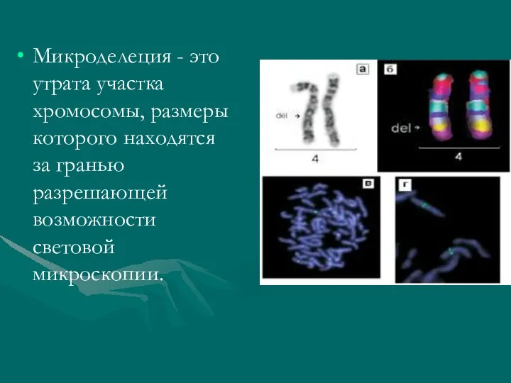 Микроделеция - это утрата участка хромосомы, размеры которого находятся за гранью разрешающей возможности световой микроскопии.
