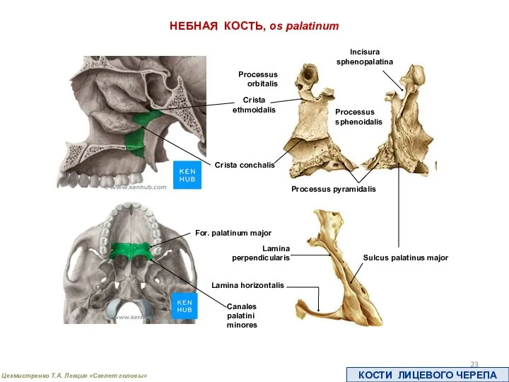 КОСТИ ЛИЦЕВОГО ЧЕРЕПА НЕБНАЯ КОСТЬ, os palatinum Lamina perpendicularis Incisura sphenopalatina Processus