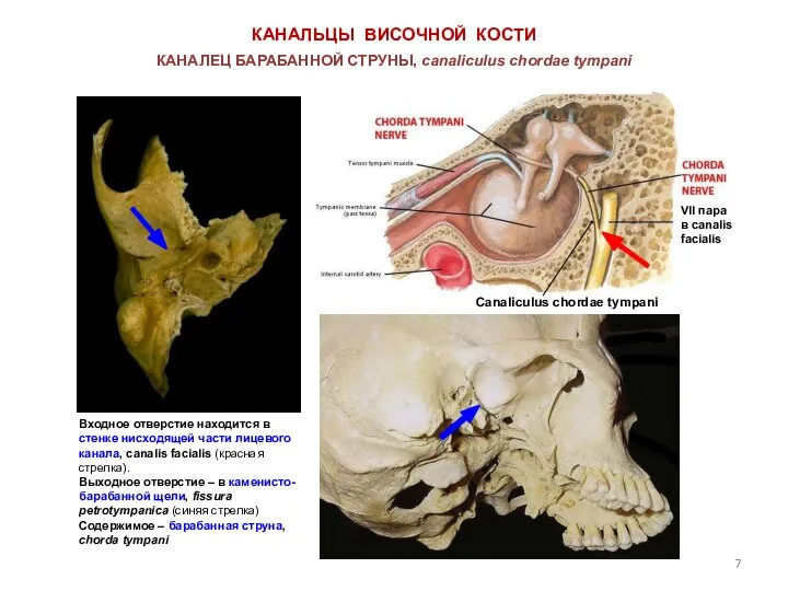 КАНАЛЬЦЫ ВИСОЧНОЙ КОСТИ Canaliculus chordae tympani КАНАЛЕЦ БАРАБАННОЙ СТРУНЫ, canaliсulus chordae tympani