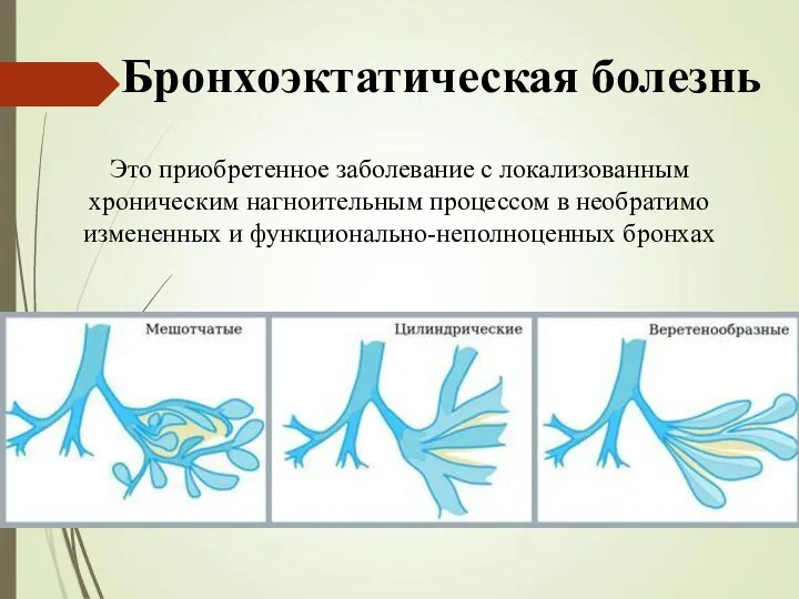 Бронхоэктатическая болезнь Это приобретенное заболевание с локализованным хроническим нагноительным процессом в необратимо измененных и функционально-неполноценных бронхах