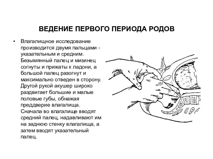 Влагалищное исследование производится двумя пальцами -указательным и средним. Безымянный палец и мизинец