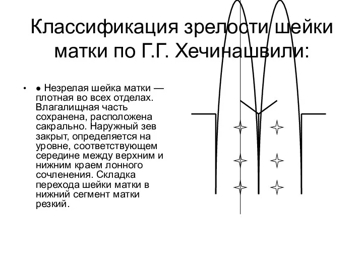 Классификация зрелости шейки матки по Г.Г. Хечинашвили: ● Незрелая шейка матки —