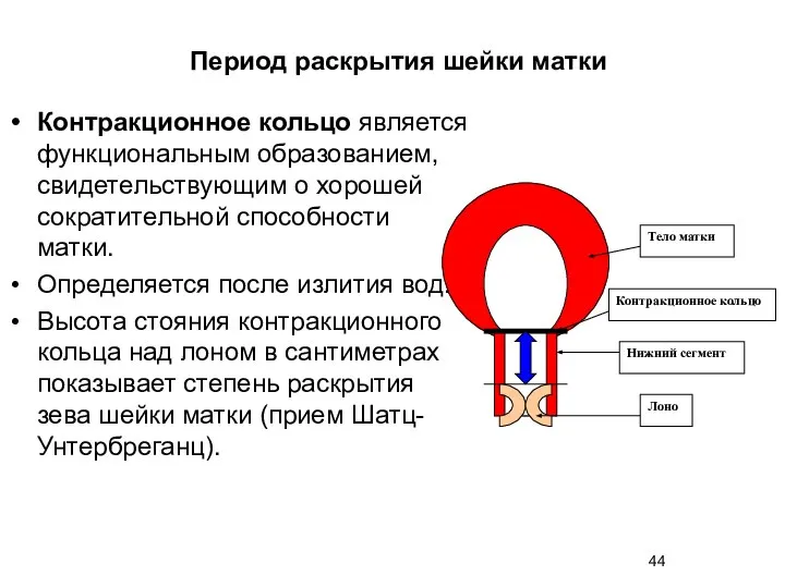 Контракционное кольцо является функциональным образованием, свидетельствующим о хорошей сократительной способности матки. Определяется