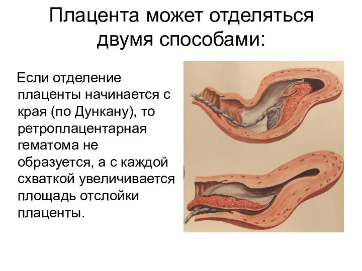 Плацента может отделяться двумя способами: Если отделение плаценты начинается с края (по