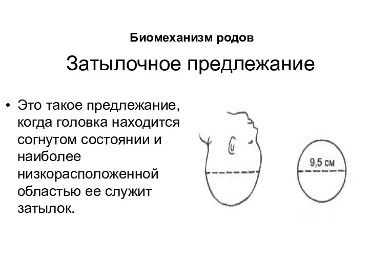 Затылочное предлежание Это такое предлежание, когда головка находится в согнутом состоянии и