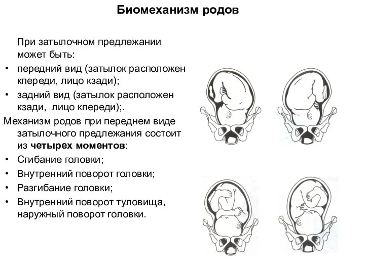 При затылочном предлежании может быть: передний вид (затылок расположен кпереди, лицо кзади);