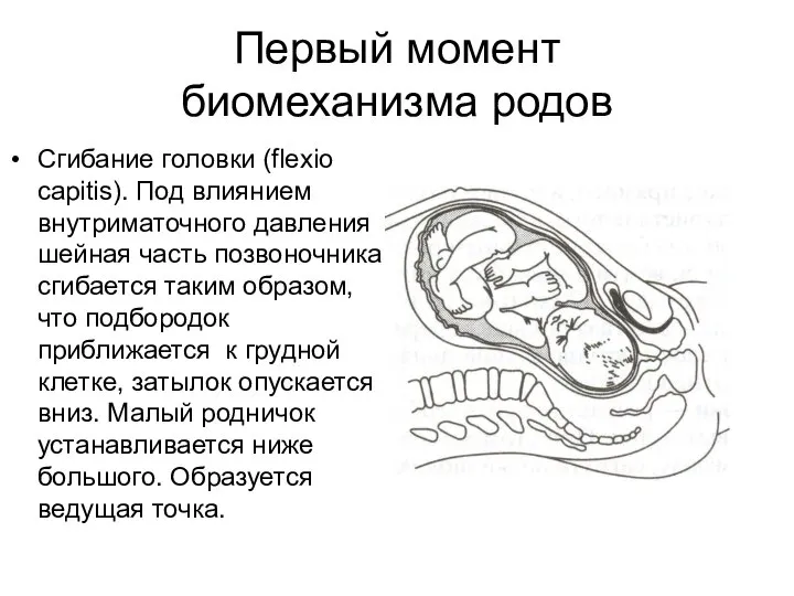 Первый момент биомеханизма родов Сгибание головки (flexio capitis). Под влиянием внутриматочного давления