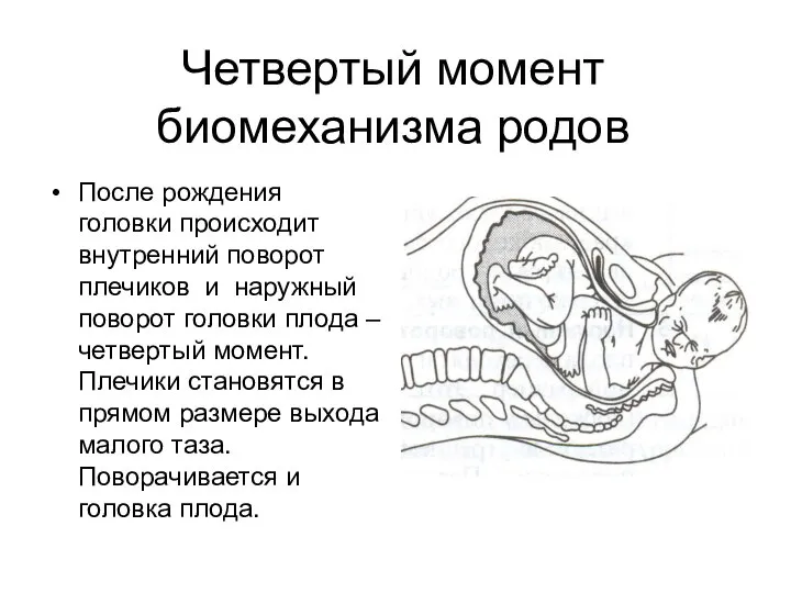 После рождения головки происходит внутренний поворот плечиков и наружный поворот головки плода
