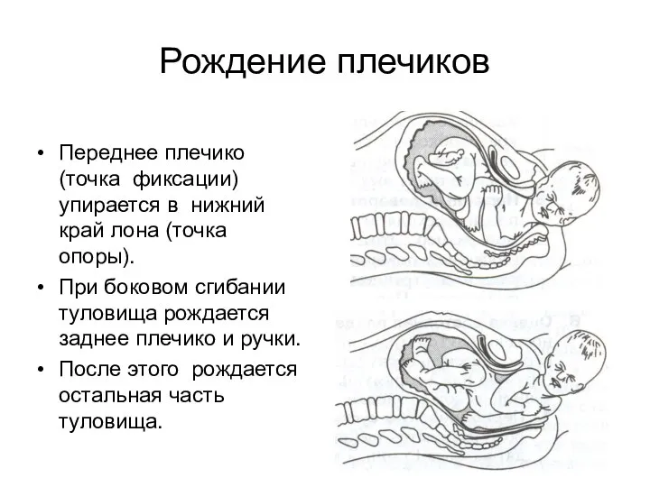 Рождение плечиков Переднее плечико (точка фиксации) упирается в нижний край лона (точка