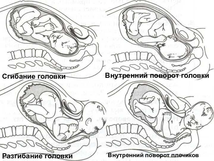 Сгибание головки Внутренний поворот головки Разгибание головки Внутренний поворот плечиков