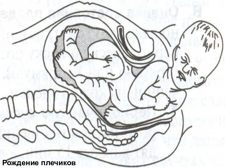 Рождение плечиков