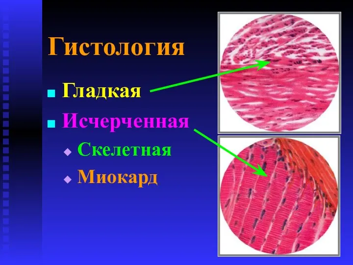 Гистология Гладкая Исчерченная Скелетная Миокард