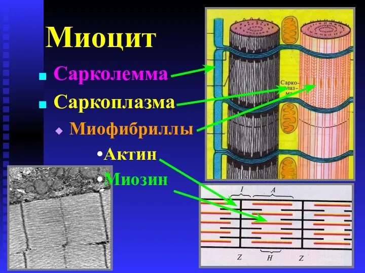 Миоцит Сарколемма Саркоплазма Миофибриллы Актин Миозин