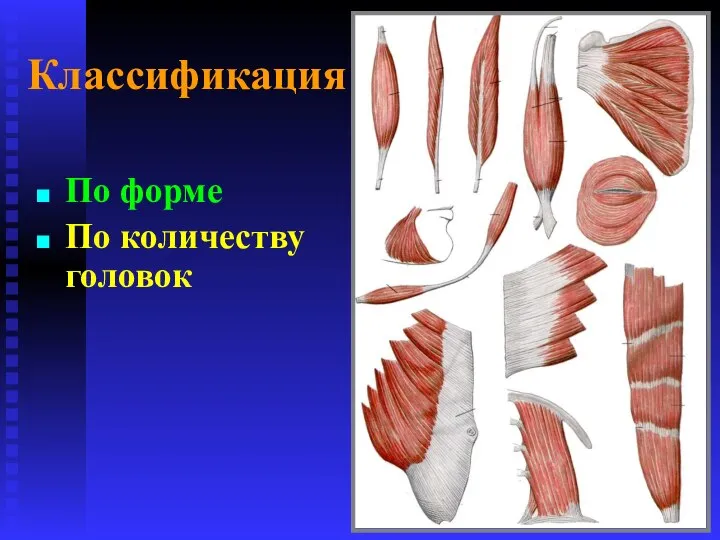 Классификация По форме По количеству головок