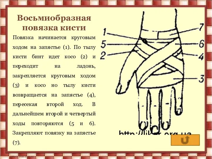 Восьмиобразная повязка кисти Повязка начинается круговым ходом на запястье (1). По тылу