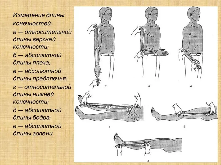 Измерение длины конечностей: а — относительной длины верхней конечности; б — абсолютной