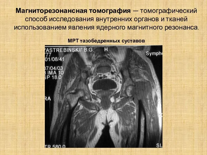 Магниторезонансная томография — томографический способ исследования внутренних органов и тканей использованием явления