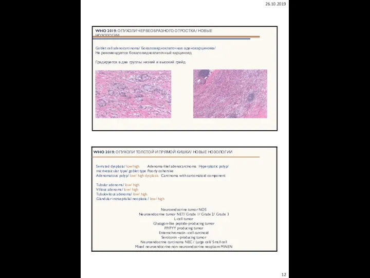 26.10.2019 WHO 2019: ОПУХОЛИ ЧЕРВЕОБРАЗНОГО ОТРОСТКА/ НОВЫЕ НОЗОЛОГИИ Goblet cell adenocarcinoma/ Бокаловидноклеточная