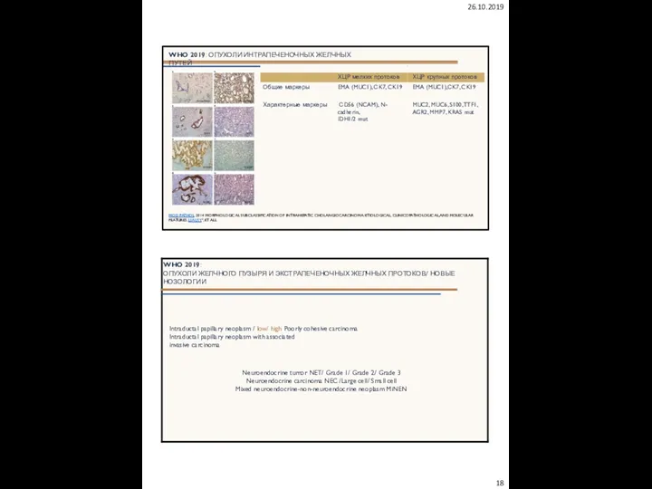 26.10.2019 WHO 2019: ОПУХОЛИ ИНТРАПЕЧЕНОЧНЫХ ЖЕЛЧНЫХ ПУТЕЙ MOD PATHOL. 2014 MORPHOLOGICAL SUBCLASSIFICATION