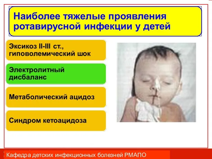 Кафедра детских инфекционных болезней РМАПО