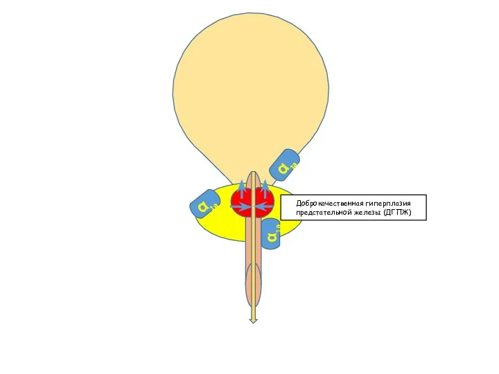α1а α1а α1а Доброкачественная гиперплазия предстательной железы (ДГПЖ)