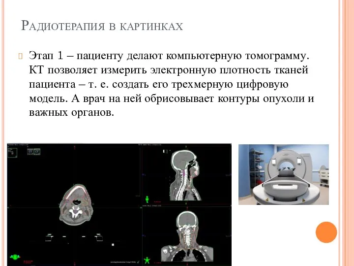 Радиотерапия в картинках Этап 1 – пациенту делают компьютерную томограмму. КТ позволяет