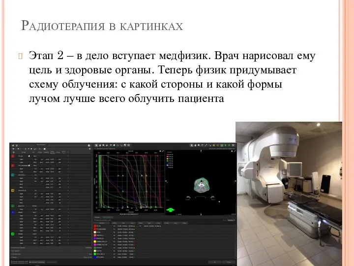 Радиотерапия в картинках Этап 2 – в дело вступает медфизик. Врач нарисовал