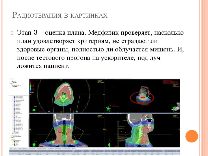 Радиотерапия в картинках Этап 3 – оценка плана. Медфизик проверяет, насколько план