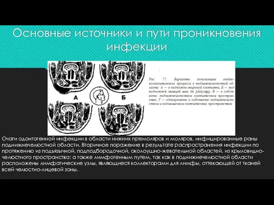 Основные источники и пути проникновения инфекции Очаги одонтогенной инфекции в области нижних