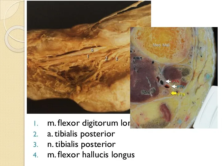 m. flexor digitorum longus a. tibialis posterior n. tibialis posterior m. flexor hallucis longus