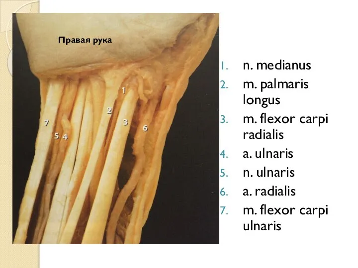 n. medianus m. palmaris longus m. flexor carpi radialis a. ulnaris n.