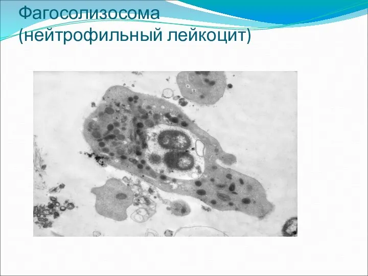 Фагосолизосома (нейтрофильный лейкоцит)