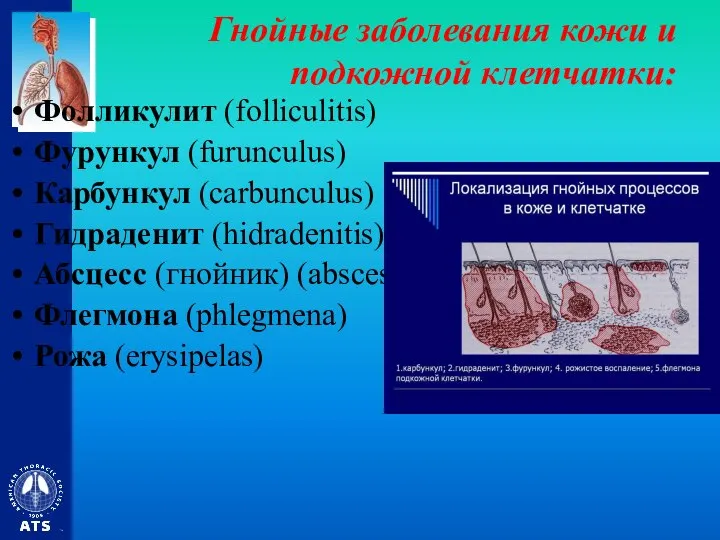 Гнойные заболевания кожи и подкожной клетчатки: Фолликулит (folliculitis) Фурункул (furunculus) Карбункул (carbunculus)