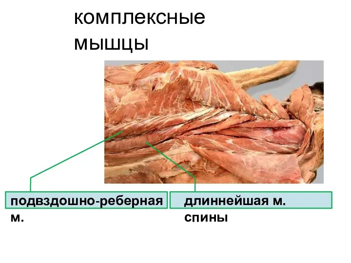 комплексные мышцы подвздошно-реберная м. длиннейшая м. спины