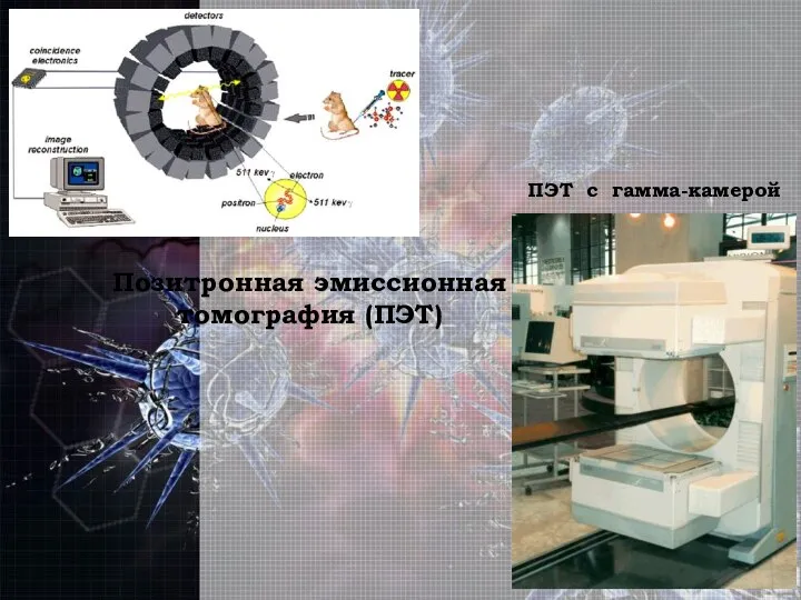 Позитронная эмиссионная томография (ПЭТ) ПЭТ с гамма-камерой