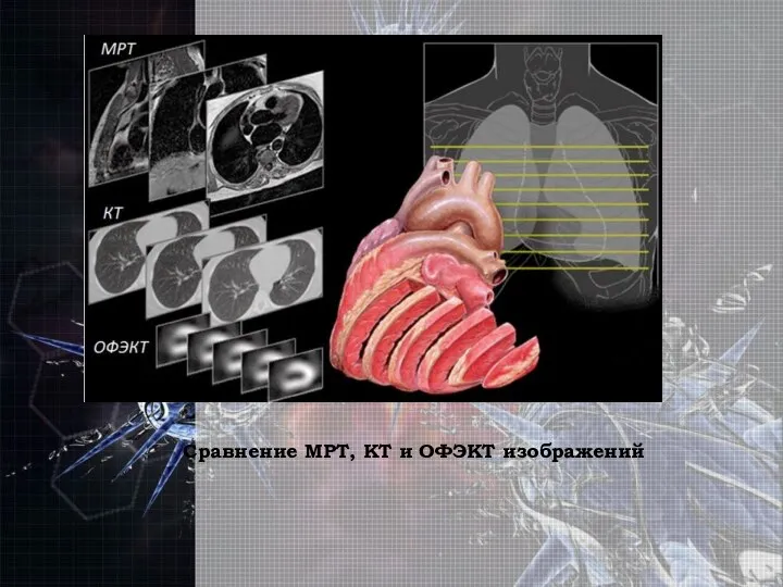 Сравнение МРТ, КТ и ОФЭКТ изображений