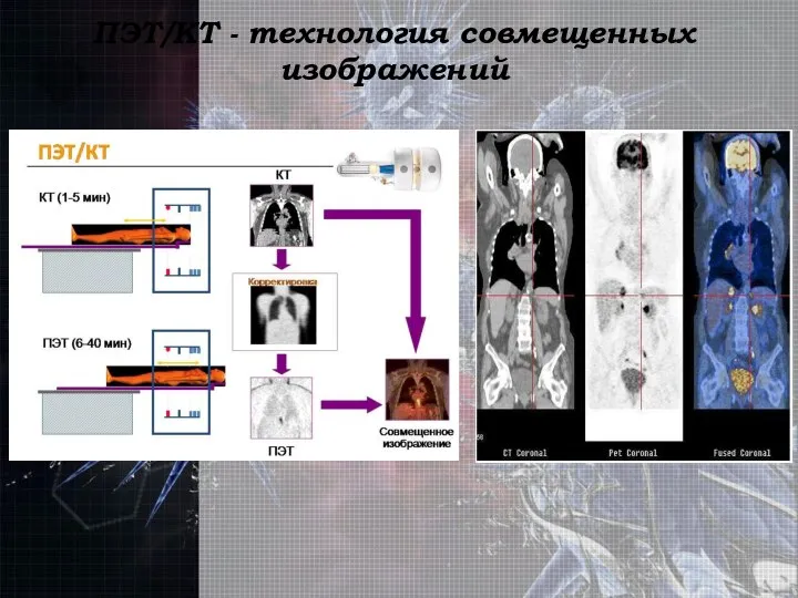 ПЭТ/КТ - технология совмещенных изображений