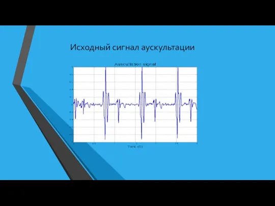 Исходный сигнал аускультации