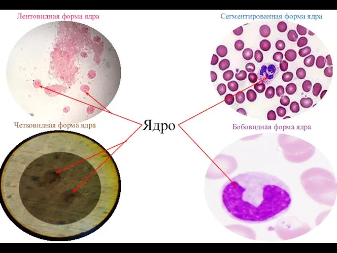 Лентовидная форма ядра Четковидная форма ядра Сегментированная форма ядра Бобовидная форма ядра Ядро